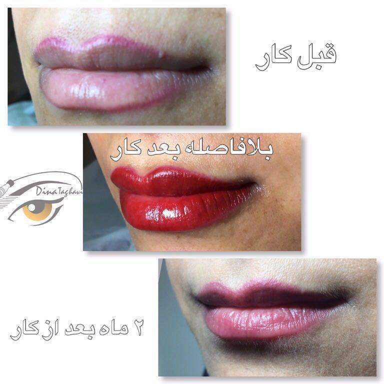 تاتو لب قیطریه رژلب