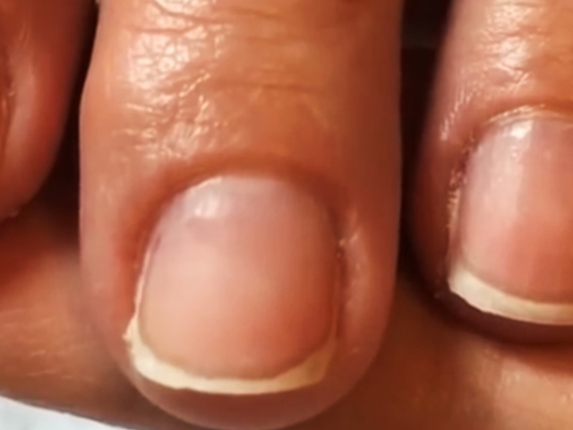 How To: Nail Extension Steam Removal