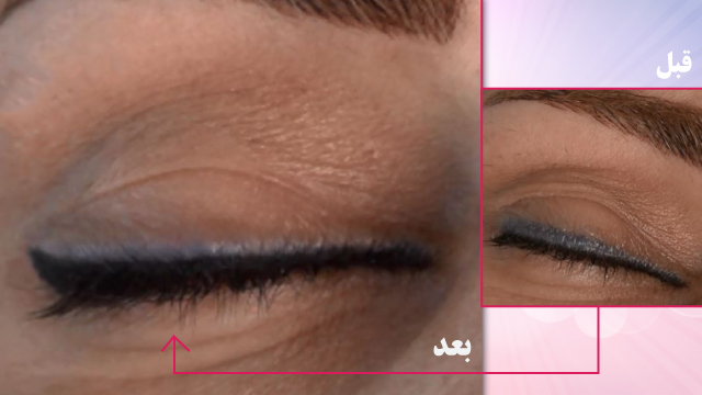 Easy Eyeliner Restoration With Micro-pigmentation